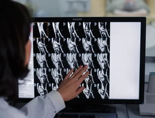 IA en el diagnóstico por imagen: el nuevo estándar clínico