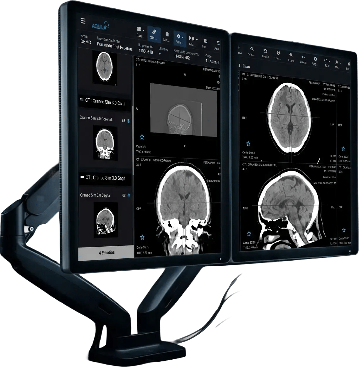 contraluz-17-monitores-tc-craneo-nobg
