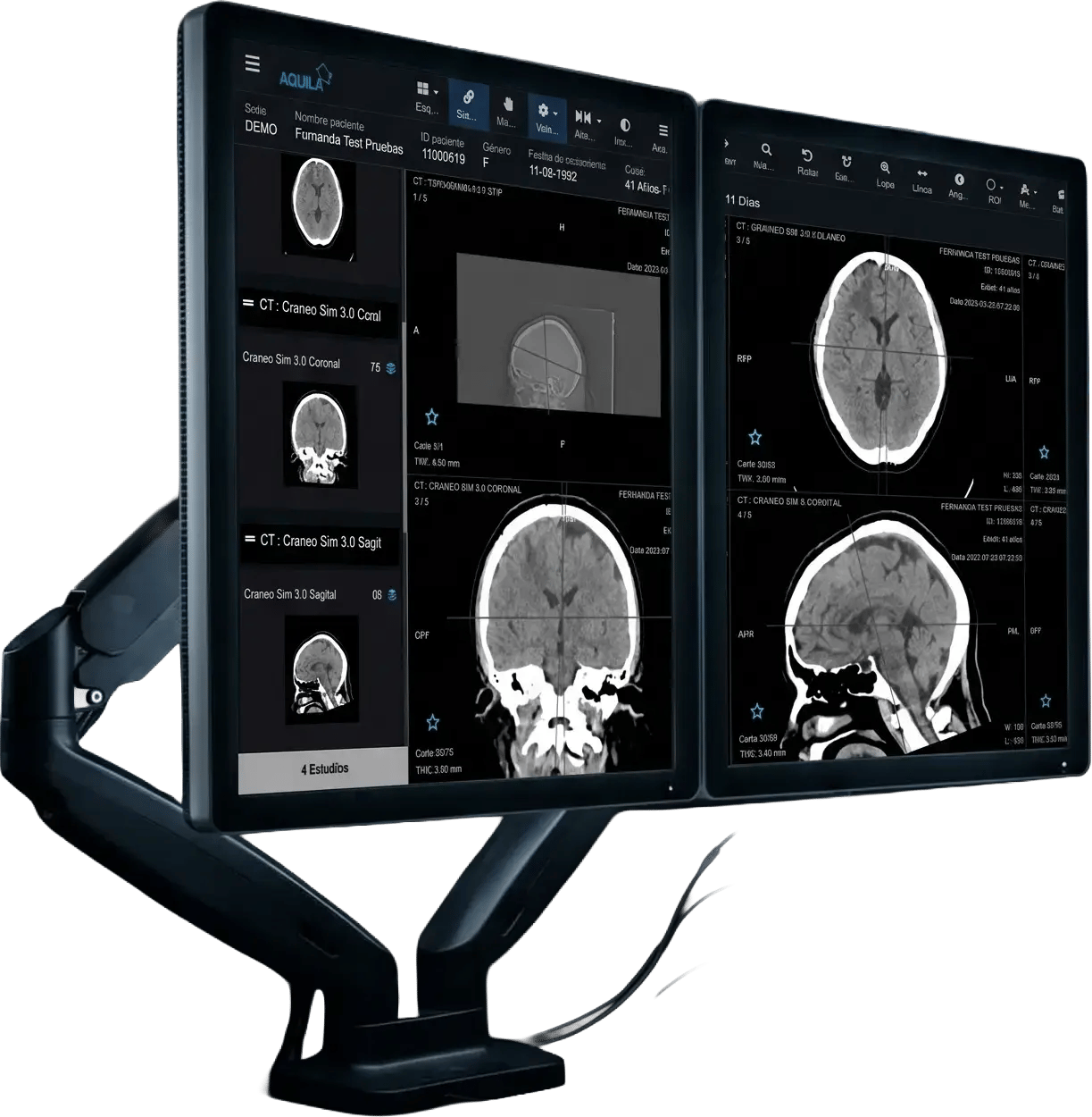contraluz-17-monitores-tc-craneo-nobg