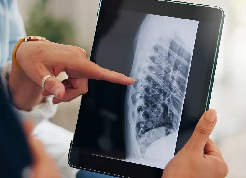 teleradiologia-agil-segura-nube-aquila-plus-imexhs