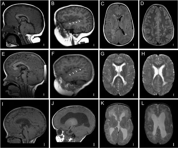 Magnetic Resonance Imaging