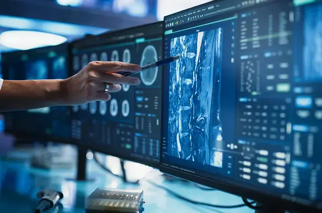 Pantallas con estudios radiológicos avanzados y un profesional señalando detalles en una imagen médica, representando la escalabilidad de Aquila+ de IMEXHS para gestionar múltiples sedes, usuarios y volúmenes sin límites de crecimiento.