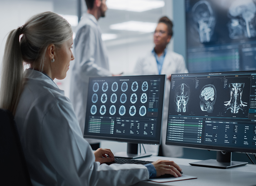 Profesional de radiología analizando imágenes cerebrales en monitores digitales, representando la necesidad de una radiología integrada para optimizar el flujo clínico y evitar reprocesos con Aquila+ de IMEXHS.