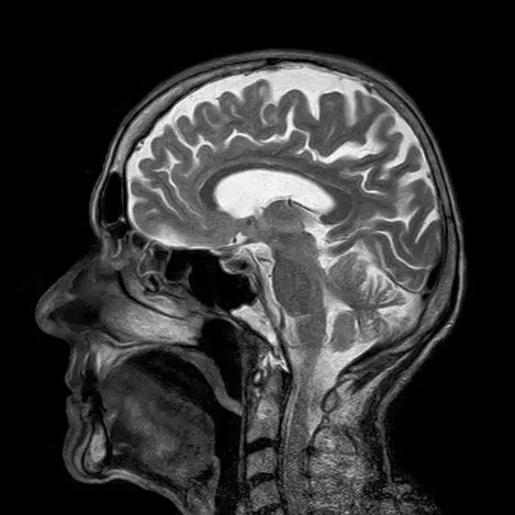 MRI Monitor: Toning Down the Contrast