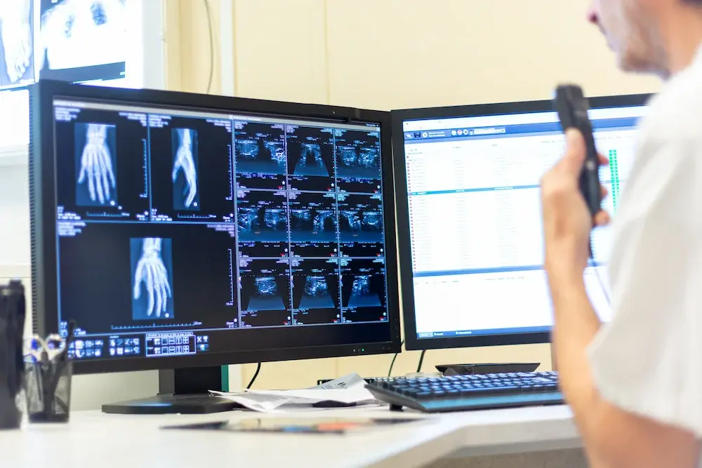 ¿Cómo el software RIS PACS optimiza la productividad?